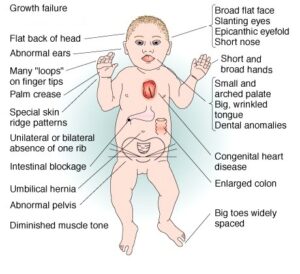 मानवी रोग: रोगांचे वर्गीकरण आणि रोगांचे कारणे | Classification of Diseases and Causes of Diseases_280.1