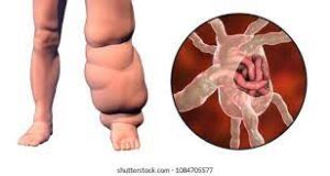 मानवी रोग: रोगांचे वर्गीकरण आणि रोगांचे कारणे | Classification of Diseases and Causes of Diseases_270.1