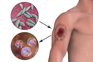मानवी रोग: रोगांचे वर्गीकरण आणि रोगांचे कारणे | Classification of Diseases and Causes of Diseases_240.1