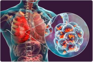 मानवी रोग: रोगांचे वर्गीकरण आणि रोगांचे कारणे | Classification of Diseases and Causes of Diseases_200.1