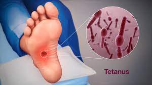 मानवी रोग: रोगांचे वर्गीकरण आणि रोगांचे कारणे | Classification of Diseases and Causes of Diseases_190.1