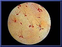 मानवी रोग: रोगांचे वर्गीकरण आणि रोगांचे कारणे | Classification of Diseases and Causes of Diseases_140.1