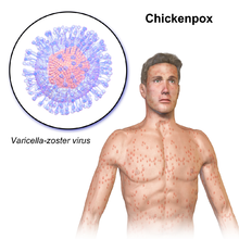 मानवी रोग: रोगांचे वर्गीकरण आणि रोगांचे कारणे | Classification of Diseases and Causes of Diseases_40.1
