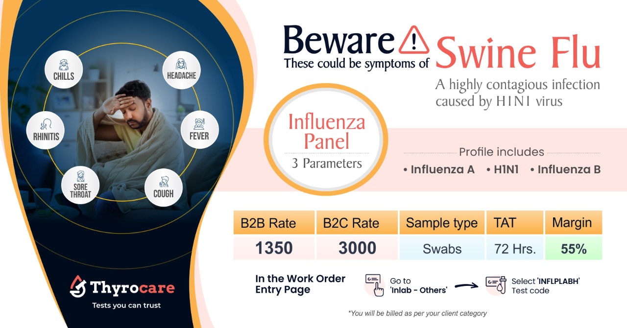 Swine Flu, Influenza thyrocare Technologies Limited