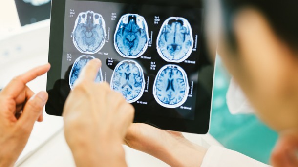 Study: Human Brain can function for hours after ‘Clinical Death’