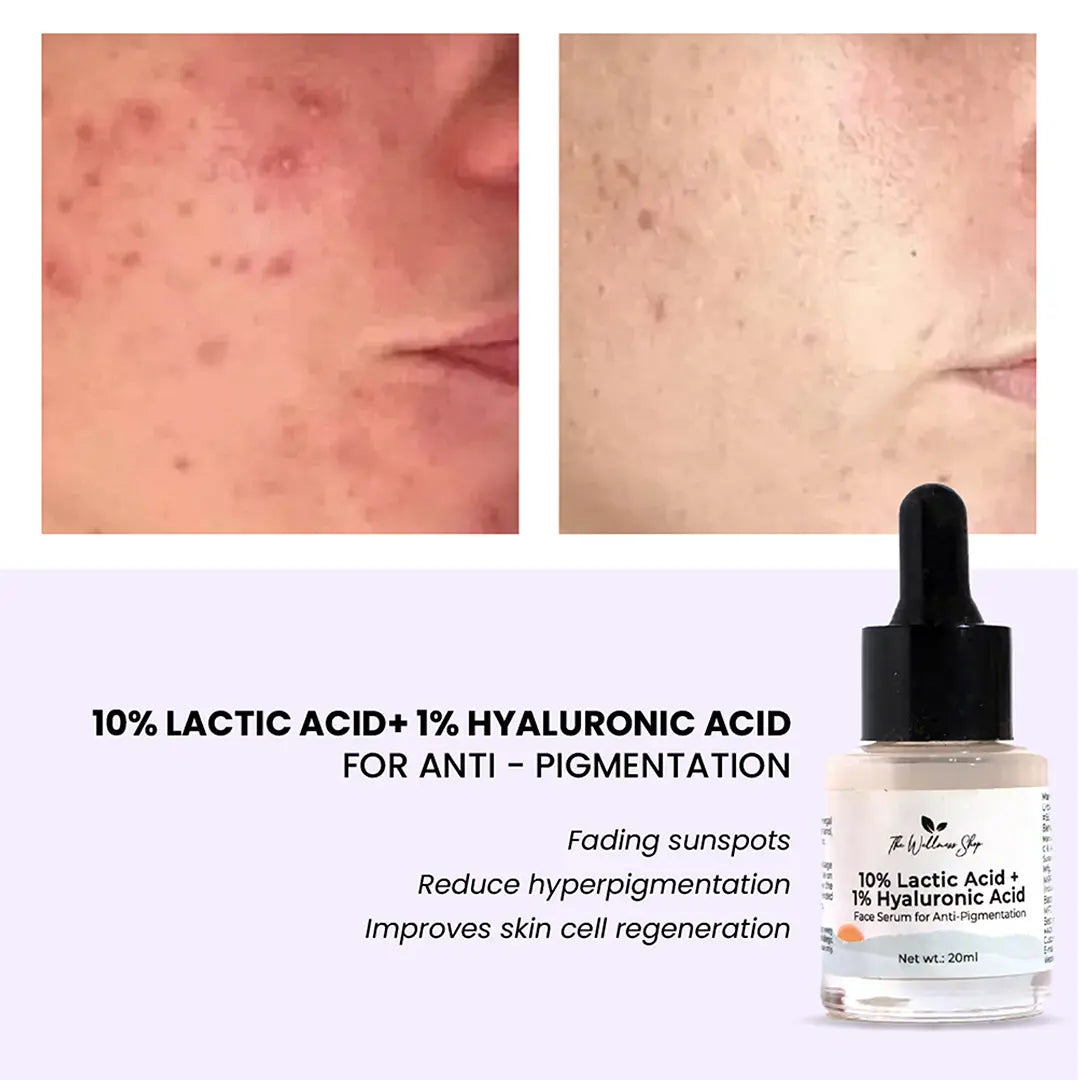 10% LACTIC ACID+ 1% HYALURONIC ACID - FACE SERUM FOR ANTI - PIGMENTATION-20ml